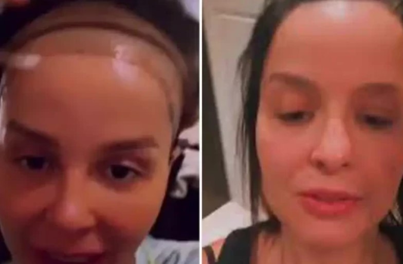 Maiara, da dupla com Maraisa, choca fãs ao surgir com cabelo diferente e revela luta contra alopecia